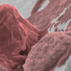 cell culture